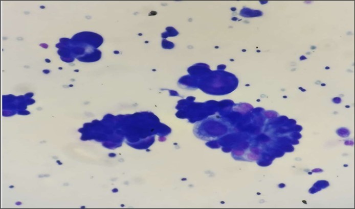 International Journal of Clinical Microbiology - pericardial fluid infection
